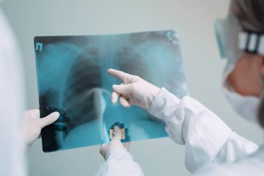 Beyaz arka planda duran doktorlar klinikteki Covid-19 hastasının zatürresi için röntgen çekiyorlar. Coronavirus konsepti