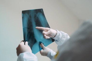 Beyaz arka planda duran doktorlar klinikteki Covid-19 hastasının zatürresi için röntgen çekiyorlar. Coronavirus konsepti