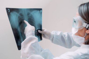 Beyaz arka planda duran doktorlar klinikteki Covid-19 hastasının zatürresi için röntgen çekiyorlar. Coronavirus konsepti