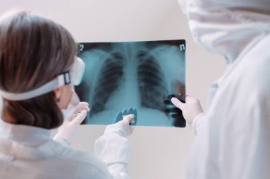 Beyaz arka planda duran doktorlar klinikteki Covid-19 hastasının zatürresi için röntgen çekiyorlar. Coronavirus konsepti