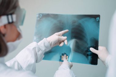Beyaz arka planda duran doktorlar klinikteki Covid-19 hastasının zatürresi için röntgen çekiyorlar. Coronavirus konsepti
