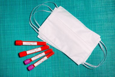 Coronavirus aşısı. Test tüplerinde Coronavirus için pozitif kan testleri