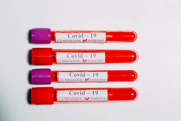 Positive Bluttests Auf Coronavirus Reagenzglas — Stockfoto