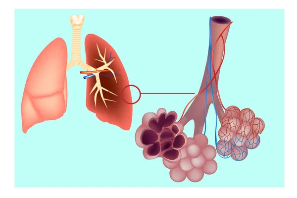 Diagrama el alveolo pulmonar (sacos de aire) en el pulmón. Los pulmones del sistema respiratorio con detalle de bronquiolos y alvéolos con red capilar. Estructura de alvéolos Anatomía — Archivo Imágenes Vectoriales