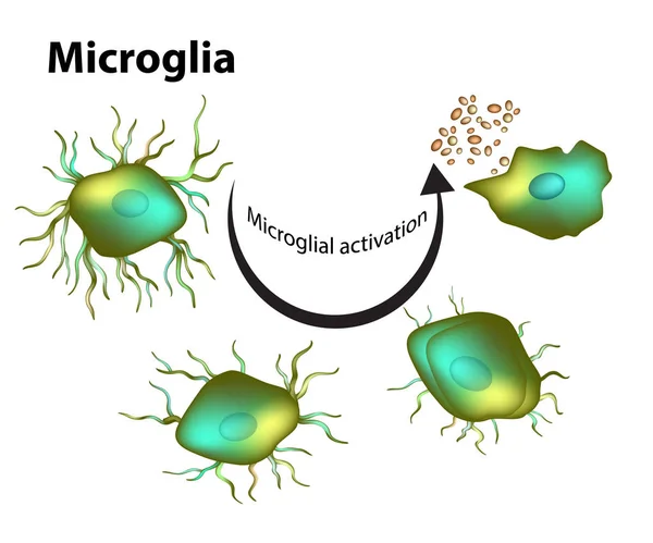 ミクログリアの活性化 ベクトル — ストックベクタ