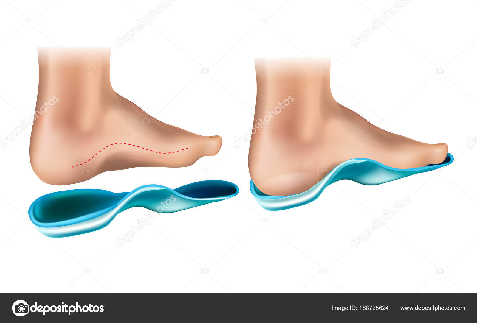 Orthopedic Insole Orthotic Arch Support 