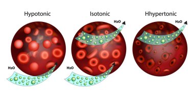 Effect of different solutions on blood cells.The effect of osmosis on cells. Hypotonic, Isotonic, and Hypertonic solution. Tonicity clipart