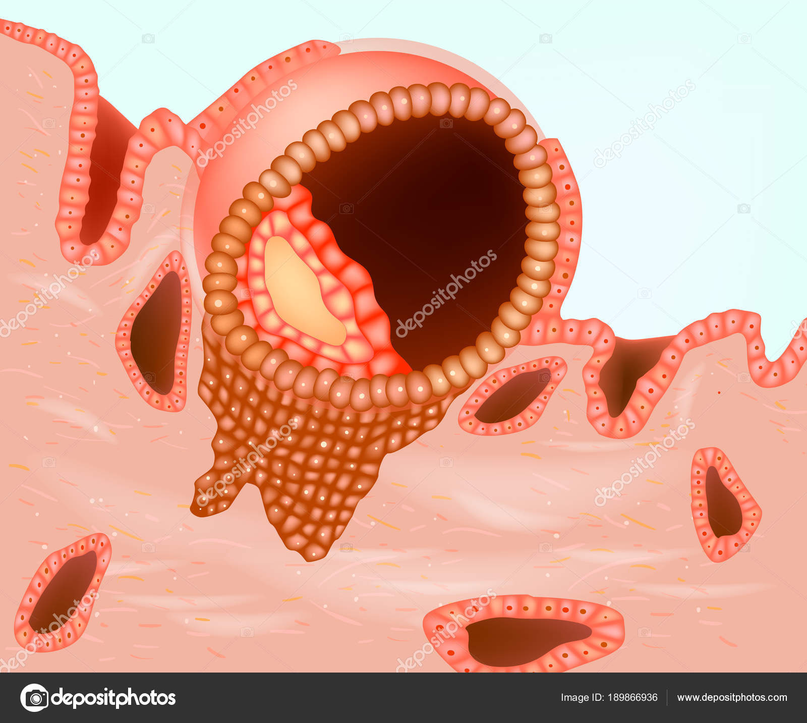 Diagram Shows Implanted Embryo Implantation  Placentation 