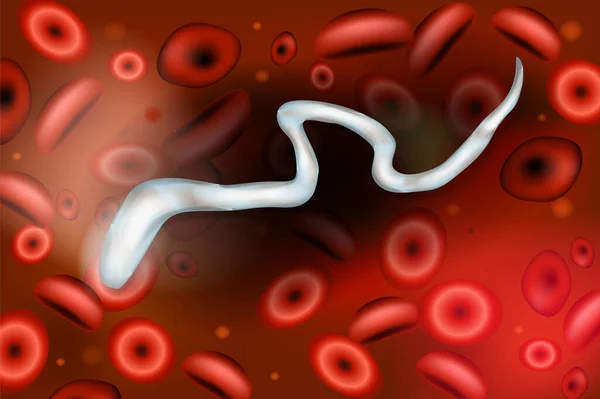 Microfilaria Gusanos Sangre Parásitos — Archivo Imágenes Vectoriales