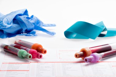 Kan testi, kan örnekleri laboratuvar form üzerindeki