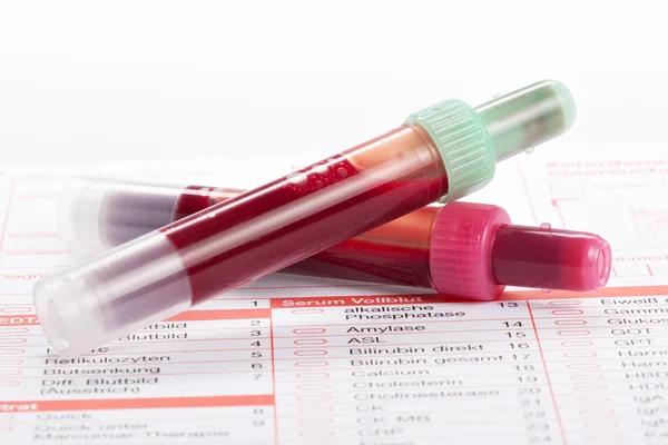 Exame de sangue, amostras de sangue em forma de laboratório — Fotografia de Stock