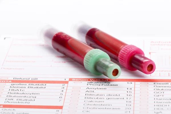 Blood test, blood samples on a laboratory form — Stock Photo, Image