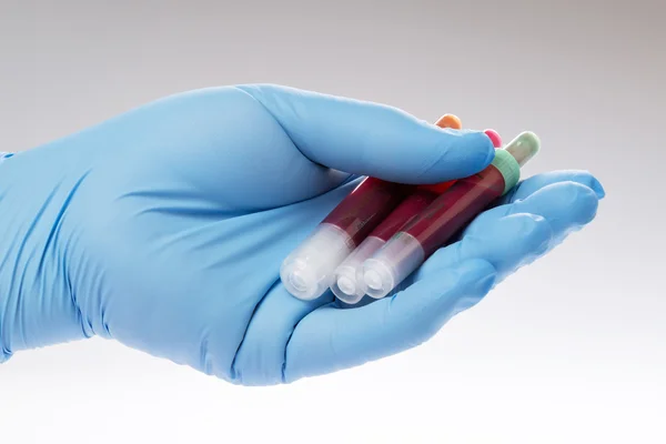 Testul de sânge, probe de sânge pe o formă de laborator — Fotografie, imagine de stoc