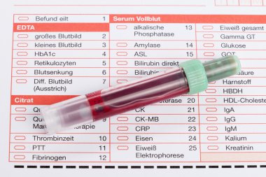 Kan testi, kan örnekleri laboratuvar form üzerindeki