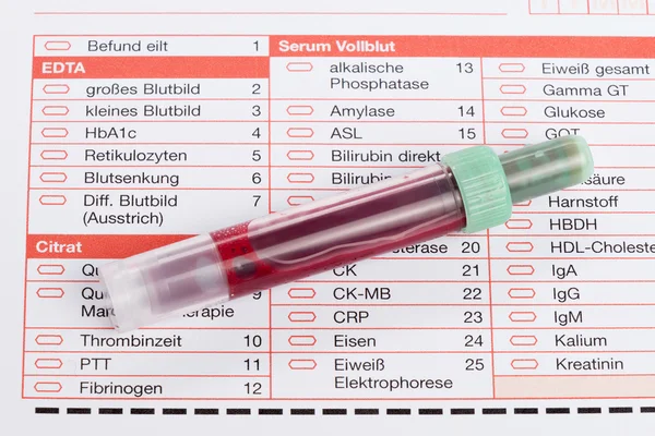 Análisis de sangre, muestras de sangre en forma de laboratorio — Foto de Stock