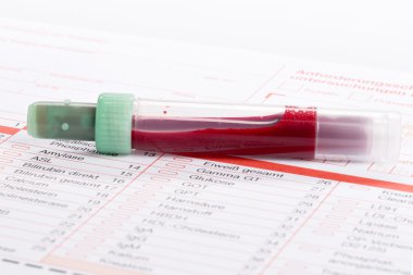 Kan testi, kan örnekleri laboratuvar form üzerindeki