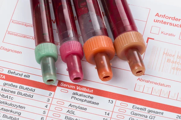 Kan testi, kan örnekleri laboratuvar form üzerindeki — Stok fotoğraf