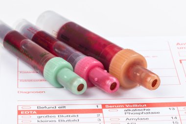 Kan testi, kan örnekleri laboratuvar form üzerindeki