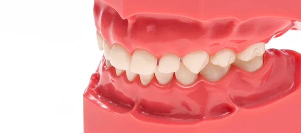 Dilatation av tänder, tanduppsättning — Stockfoto