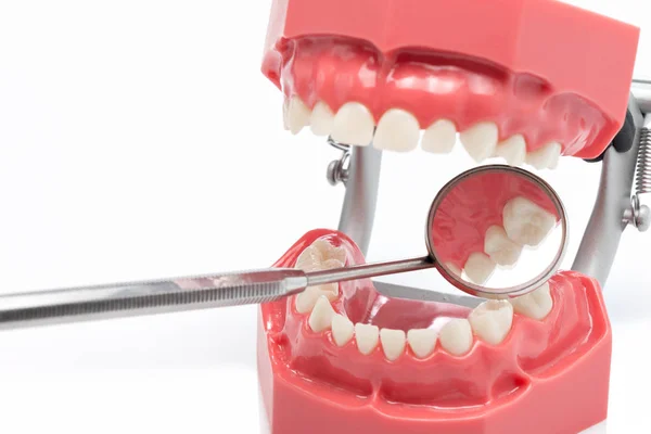 Dilatation of teeth, dentition, mirror — Stock Photo, Image