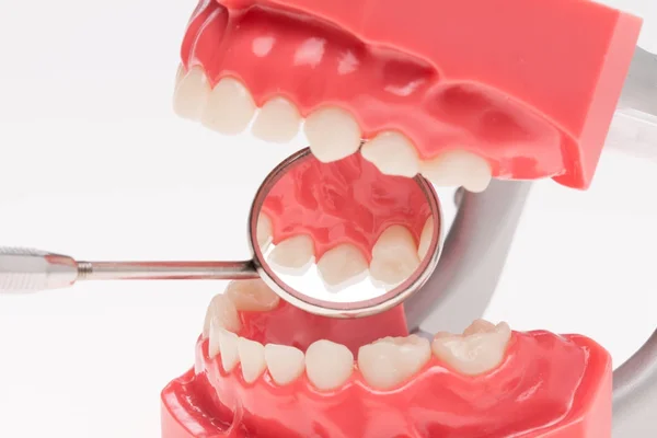 Denture, dental health, dental hygiene — Stock Photo, Image