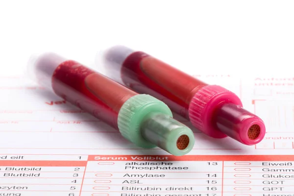 Blood test, blood samples on a laboratory form — Stock Photo, Image