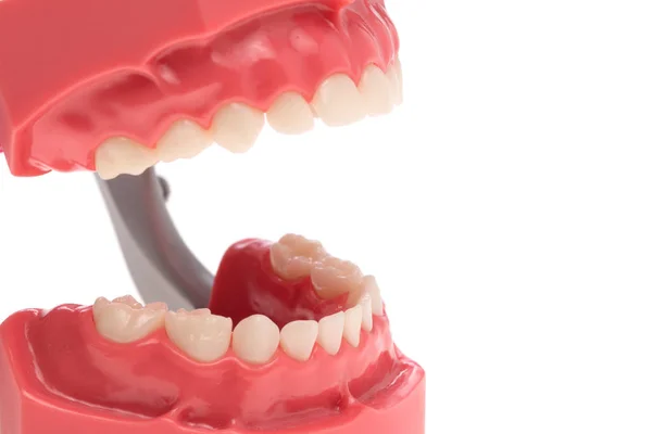 Dentatura, salute dentale, igiene dentale — Foto Stock