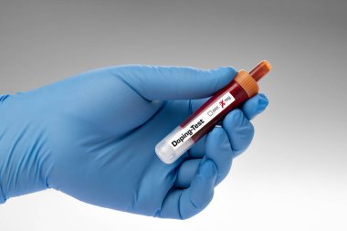 Doping, doping testi. Laboratuvarda elinde korona virüsü olan bir test tüpü tutan kişi.