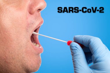 SARS-CoV-2, Covid-19; DNA test tüpü ve pamuk çubuğu, test silme
