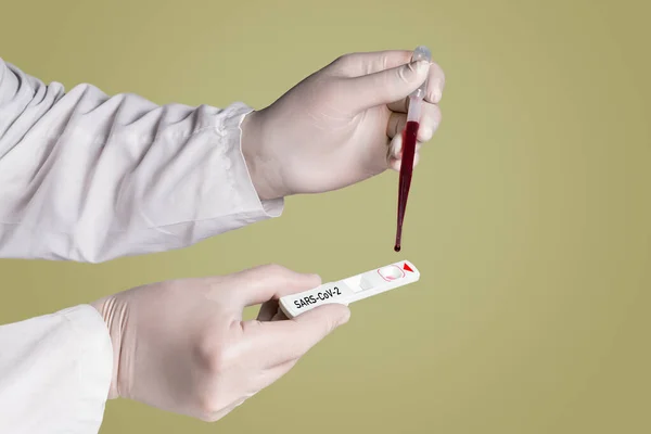 Covid Person Holds Test Tube Corona Virus Hand Laboratory — Stock Photo, Image