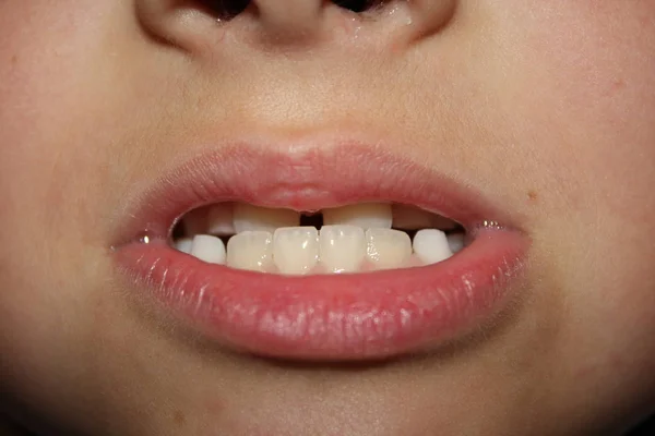 Kids Teeths Closeup Look — Stock Photo, Image