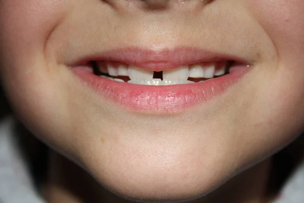 Barn Teeths Närbild Titt — Stockfoto