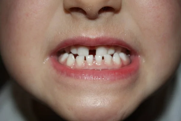 Borsta tänder, friska koncept. — Stockfoto