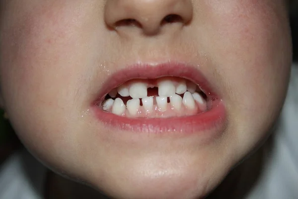 Borsta tänder, friska koncept. — Stockfoto