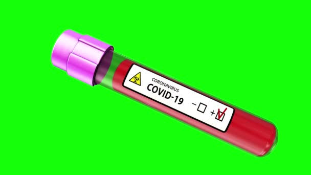 Análisis Sangre Brote Coronavirus Covid Animación Médica Virus Alerta Gripe — Vídeo de stock