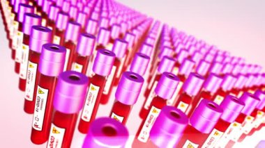 Kan testi 4K COVID 19 Coronavirüs salgını mikroskop animasyonu. 2019 ncov arka plan. Virüs tehlikeli. Grip alarmı