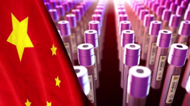 Kan testi 4K Çin COVID 19 Coronavirüs salgını mikroskop animasyonu 2019 ncov arkaplan. Virüs tehlikeli. Grip alarmı