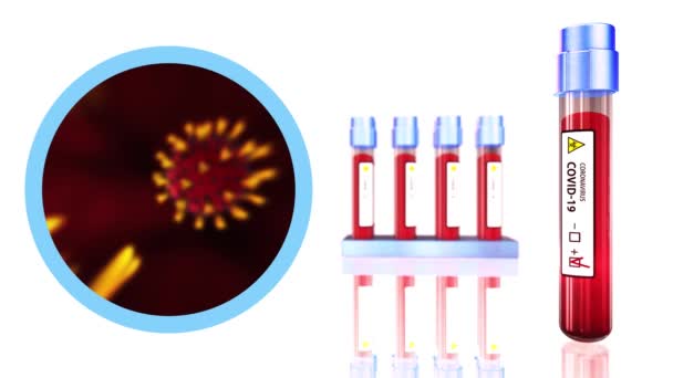 Tablas Pandémicas Análisis Sangre China Covid Animación Microscópica Brote Coronavirus — Vídeos de Stock