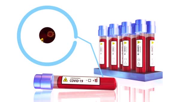 Пандемические Диаграммы Анализа Крови China Covid Coronavirus Outbreak Microscope Animation — стоковое видео