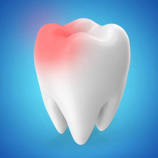 Conceito de dor de dente, conceito de cárie isolado em tons azuis. Renderização 3D — Fotografia de Stock