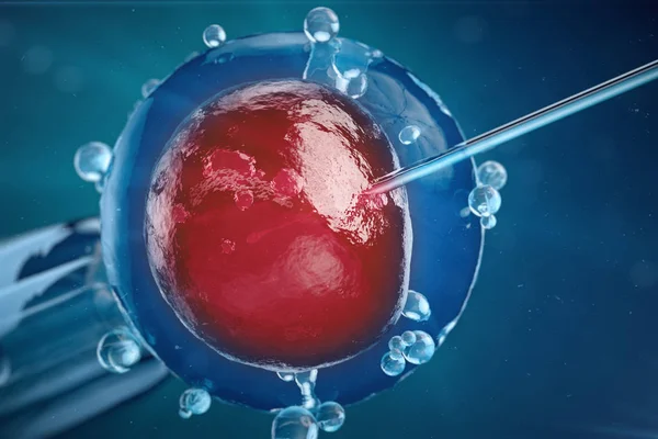 3D illustration In vitro fertilisation, Injecting spermie in i äggcellen, assisterad reproduktiv behandling. — Stockfoto