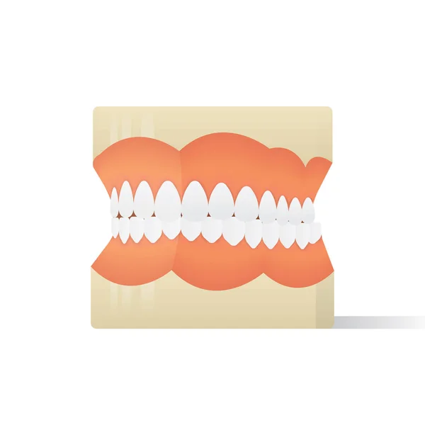 Modelo de dentaduras vetor de ilustração sobre fundo branco. Médico —  Vetores de Stock