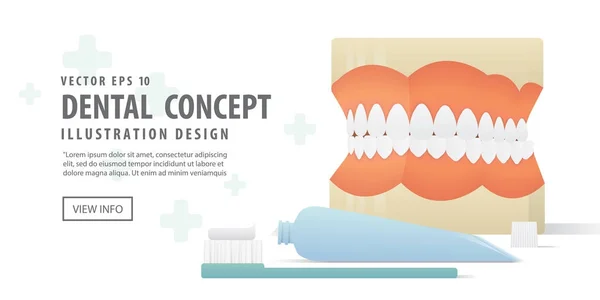 Banner Modelo de prótesis dentales e ilustración de cepillo de dientes y pasta de dientes — Vector de stock