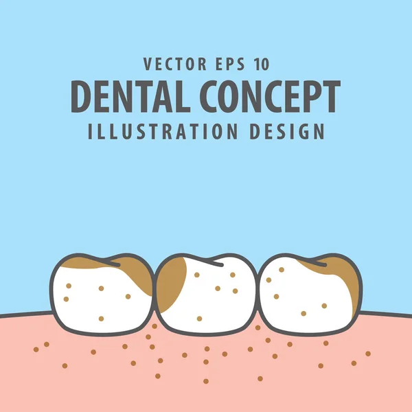 Denti sporchi vettore illustrazione su sfondo blu. Conce dentale — Vettoriale Stock