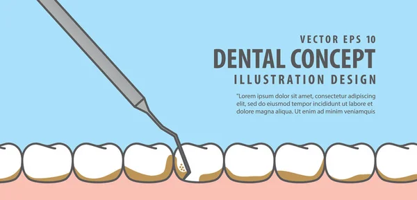 Banner Escala dentes ilustração vetor no fundo azul. Den... —  Vetores de Stock