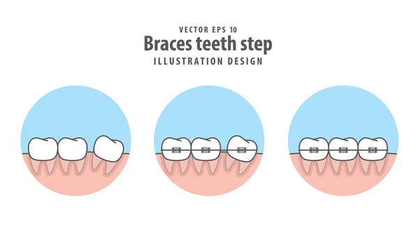 Diş telleri diş daire illüstrasyon vektör içinde üzerinde beyaz backgro adım. — Stok Vektör