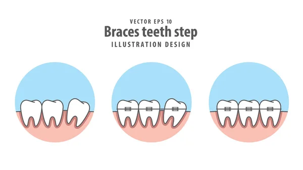 Braçadeiras passo dentes em círculo ilustração vetor em branco backgro — Vetor de Stock