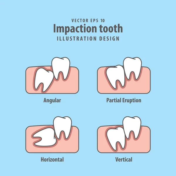 파란색 배경에 impaction 치아 일러스트 벡터입니다. 치과 c — 스톡 벡터