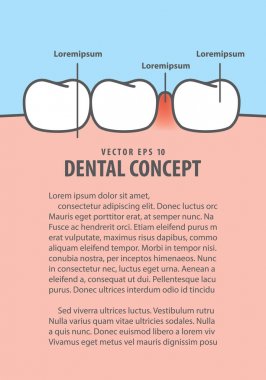Düzen şişmiş iltihap diş etleri diş çerçeve karikatür tarzı ile 