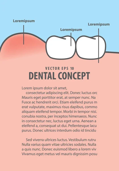 Layout Gomas inchadas com estilo de desenho animado de moldura de dentes para informações ou b —  Vetores de Stock